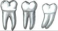 Schneidezähne haben in der Regel nur eine Zahnwurzel, während Backenzähne (...