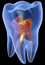 Die Zahnwurzel, auch Pulpa genannt, versorgt den Zahn mit Lymphflüssigkeit und hält ihn am Leben. Ist sie beschädigt, stirbt der Zahn ab.