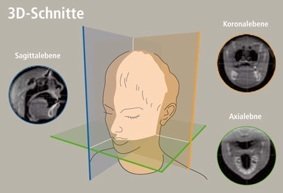 Mithilfe der Tomographie können dreidimensionale Bilder des Inneren des menschlichen Körpers erzeugt werden für bessere Diagnose- und Behandlungsverfahren.