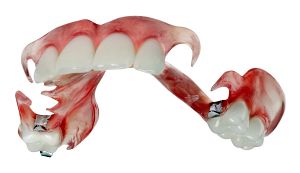 Die Zahnprothese unterscheidet sich vor allem in der Funktionalität und im Aufbau von anderen Prothesen