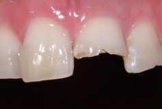 Der Speichel ist nämlich ebenso geeignet, die Zähne mit Flüssigkeit zu versorgen und vor Verschmutzung zu bewahren.