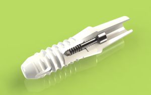 Keramikimplantate werden immer häufiger eingesetzt, da nicht jeder Patient Metallimplantate verträgt