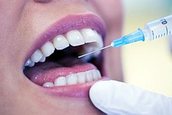 Angst vor Spritzen beim Zahnarzt erfolgreich überwinden