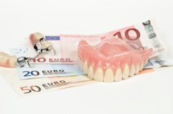 Kosten für Zahnersatz