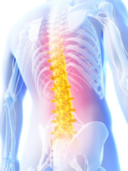 Chronische Rückenschmerzen 