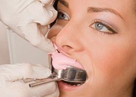 Entnahme eines Zahnabdruckes - Alginat