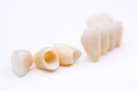 Hochwertige Materialien gewährleisten stabilen und ästhetischen Zahnersatz in der Praxis.