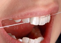Zahnseide hilft bei der Mundhygiene und sorgt dafür, dass sich auch Bakterien in den Zahnzwischenräumen nicht ansiedeln.