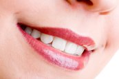 Schöne Zähne nach einer professionellen Zahnreinigung