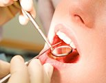 Implantation: Als Vorbereitung auf eine Implantation sorgt der Zahnarzt dafür, dass alle Zahnkrankheiten behandelt werden.