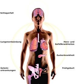 Bei starken Entzündungen am Zahn bzw. Zahnfleisch können diese auf den gesamten Organismus übergehen und hier Risiken für andere Krankheiten steigern. Dazu gehört das Risiko für einen Herzinfarkt oder Schlaganfall.