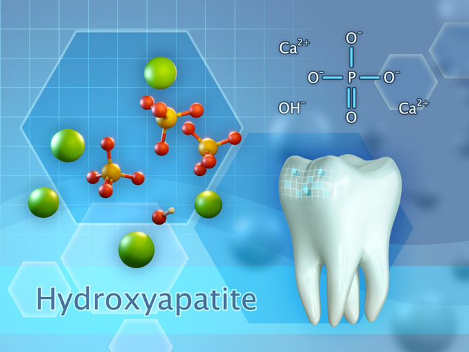 Hydroxylapatit