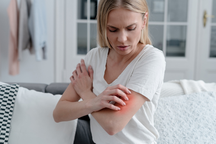 Frau mit Neurodermitis