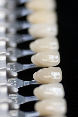 Auf welche Punkte Sie zuhause bei der Wahl von Zahnverfärbung entfernen achten sollten