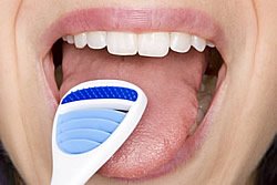 Auf der Zunge sammeln sich viele Bakterien, die selten entfernt werden. Ein Zungenschaber sollte daher regelmäßig angewendet werden, um Karies zu vermeiden.