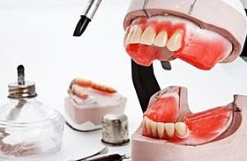 Zahnersatz wie gewachsene Zähne - Feste Zähne sind im Alter ein großer Faktor für die persönliche Lebensqualität im Alltag.