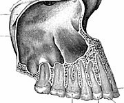 Kieferhöhle (Sinus Maxillaris)